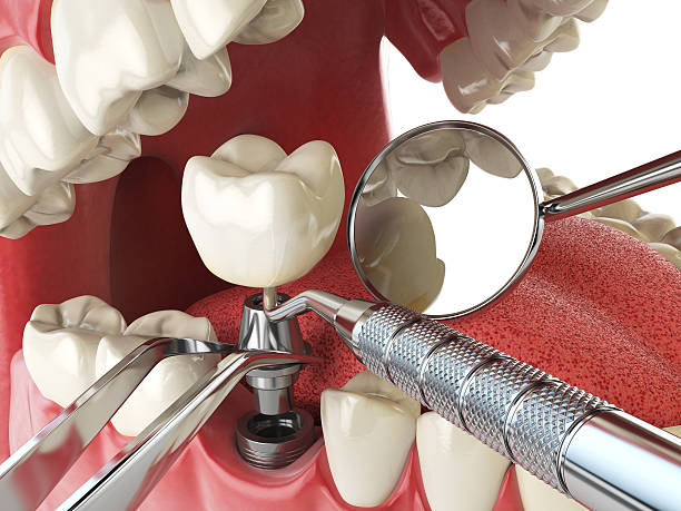 Best Emergency Treatment for Jaw Pain or Injury in East Palatka, FL